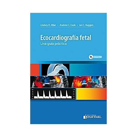 ECOCARDIOGRAFIA FETAL. UNA GUIA PRACTICA + DVD