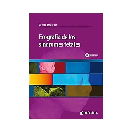 ECOGRAFIA DE LOS SINDROMES FETALES + DVD