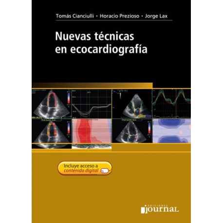 NUEVAS TECNICAS EN ECOCARDIOGRAFIA + ACCESO ONLINE