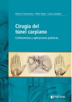 CIRUGIA DEL TUNEL CARPIANO