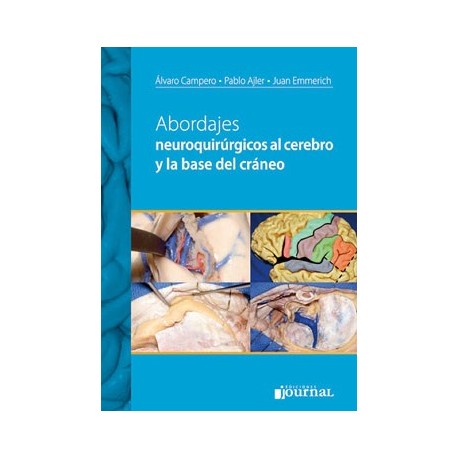 ABORDAJES NEUROQUIRURGICOS AL CEREBRO Y LA BASE DE CRANEO