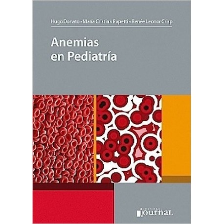 ANEMIAS EN PEDIATRIA