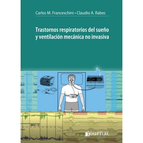TRASTORNOS RESPIRATORIOS DEL SUEÑO Y VENTILACION MECANICA NO INVASIVA
