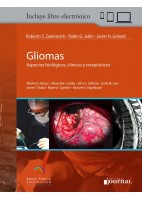 GLIOMAS. ASPECTOS BIOLOGICOS, CLINICOS Y TERAPEUTICOS + ACCESO ONLINE