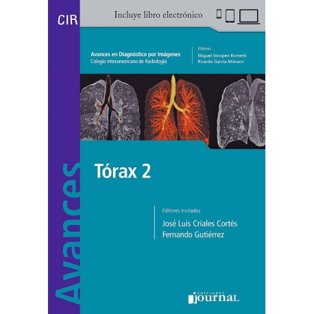 AVANCES EN DIAGNOSTICO POR IMAGENES 17: TORAX 2 (CIR, COLEGIO INTERAMERICANO DE RADIOLOGIA (LIBRO + LIBRO ELECTRONICO)