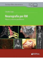 NEUROGRAFIA POR RM (LIBRO + EBOOK)