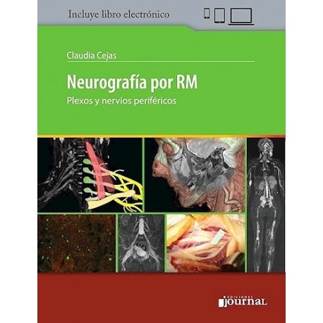 NEUROGRAFIA POR RM (LIBRO + EBOOK)