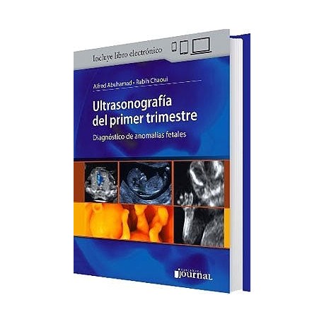 ULTRASONOGRAFIA DEL PRIMER TRIMESTRE