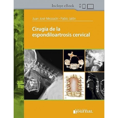 CIRUGIA DE LA ESPONDILOARTROSIS CERVICAL (INCLUYE E-BOOK)