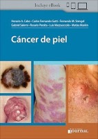 CANCER DE PIEL