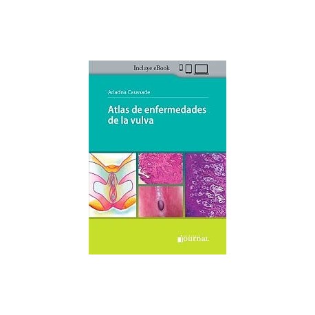 ATLAS DE ENFERMEDADES DE LA VULVA