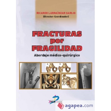 FRACTURAS POR FRAGILIDAD. ABORDAJE MEDICO-QUIRURGICO