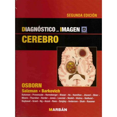 DIAGNOSTICO POR IMAGEN: CEREBRO