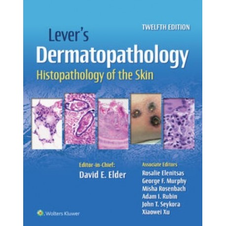 LEVER.S DERMATOPATHOLOGY. HISTOPATHOLOGY OF THE SKIN