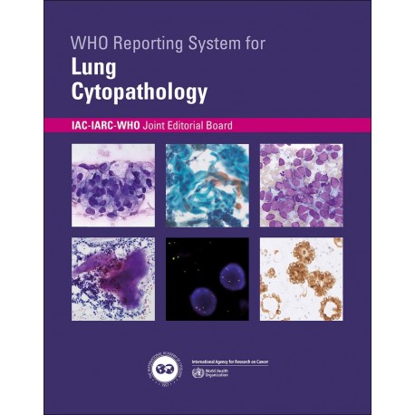 WHO REPORTING SYSTEM FOR LUNG CYTOPAHTOLOGY