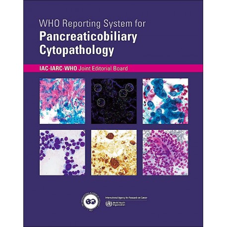 WHO REPORTING SYSTEM FOR PANCREATICOBILIARY CYTOPATHOLOGY