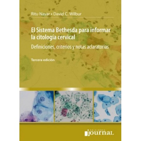 EL SISTEMA BETHESDA PARA INFORMAR LA CITOLOGIA CERVICAL