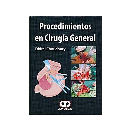 PROCEDIMIENTOS EN CIRUGIA GENERAL