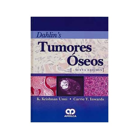 DAHLIN.S TUMORES OSEOS