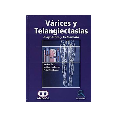 VARICES Y TELANGIECTASIAS. DIAGNOSTICO Y TRATAMIENTO