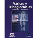 VARICES Y TELANGIECTASIAS. DIAGNOSTICO Y TRATAMIENTO