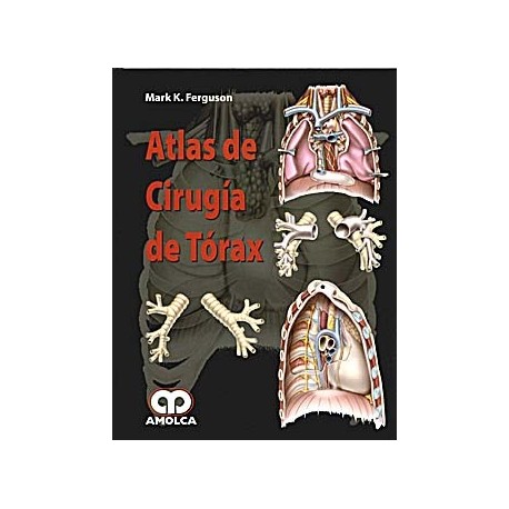ATLAS DE CIRUGIA DE TORAX