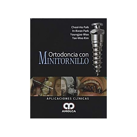 ORTODONCIA CON MINITORNILLO. APLICACIONES CLINICAS