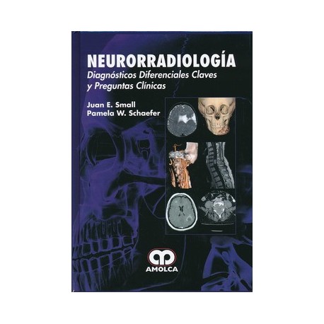 NEURORRADIOLOGIA. DIAGNOSTICOS DIFERENCIALES CLAVES Y PREGUNTAS CLINICAS