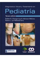 DIAGNOSTICO VISUAL Y TRATAMIENTO EN PEDIATRIA
