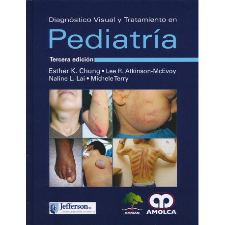 DIAGNOSTICO VISUAL Y TRATAMIENTO EN PEDIATRIA
