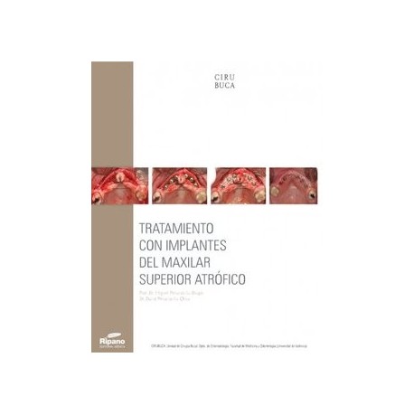 TRATAMIENTO CON IMPLANTES DEL MAXILAR SUPERIOR ATROFICO