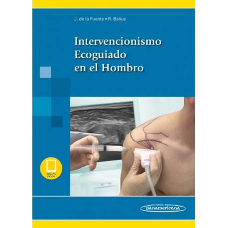 INTERVENCIONISMO ECOGUIADO EN EL HOMBRO (INCLUYE E-BOOK)