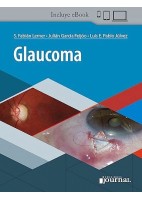 GLAUCOMA (INCLUYE E-BOOK)