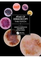 ATLAS OF DERMOSCOPY