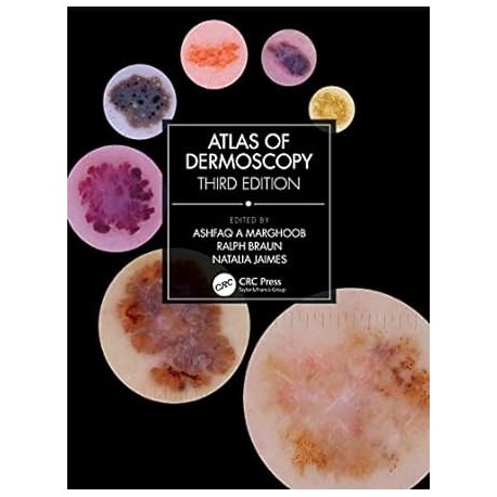ATLAS OF DERMOSCOPY
