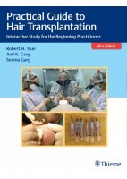PRACTICAL GUIDE TO HAIR TRANSPLANTATION. INTERACTIVE STUDY FOR THE BEGINNING PRACTITIONER
