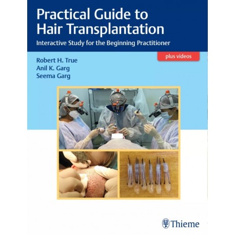 PRACTICAL GUIDE TO HAIR TRANSPLANTATION. INTERACTIVE STUDY FOR THE BEGINNING PRACTITIONER