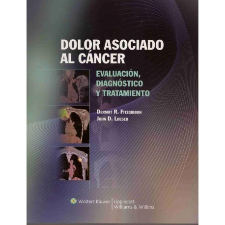 DOLOR ASOCIADO AL CANCER