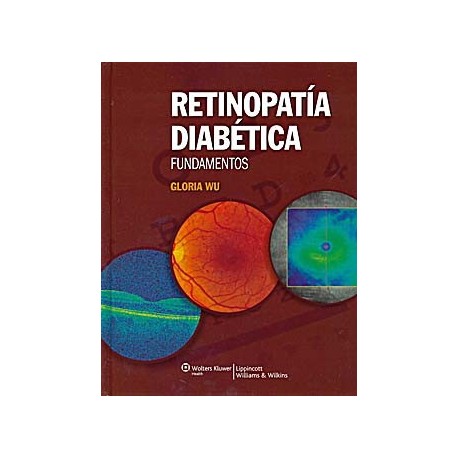 RETINOPATIA DIABETICA. FUNDAMENTOS