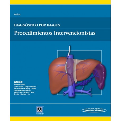 DIAGNOSTICO POR IMAGEN. PROCEDIMIENTOS INTERVENCIONISTAS