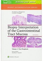 BIOPSY INTERPRETATION OF GASTROINTESTINAL TRACT MUCOSA: VOLUME 2 NEOPLASTIC