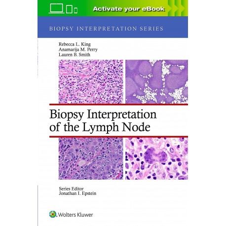 BIOPSY INTERPRETATION OF THE LIVER