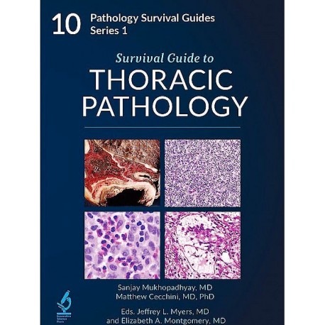 SURVIVAL GUIDE TO THORACIC PATHOLOGYY. 10 PATHOLOGY SURVIVAL GUIDES SERIES 1