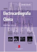 ELECTROCARDIOGRAFIA CLINICA