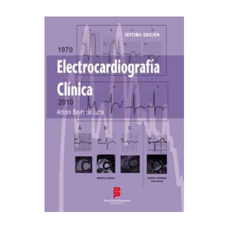 ELECTROCARDIOGRAFIA CLINICA