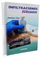 INFILTRACIONES ECOGUIADAS ESPIRAL