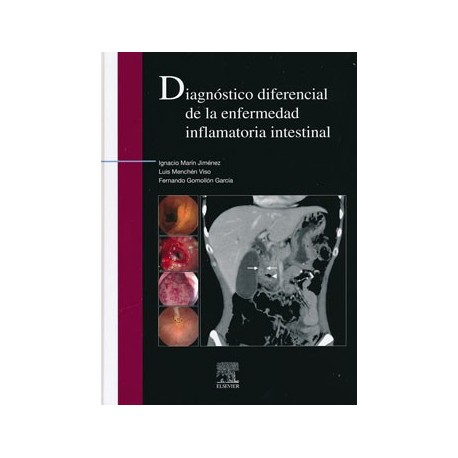 DIAGNOSTICO DIFERENCIAL DE LA ENFERMEDAD INFLAMATORIA INTESTINAL