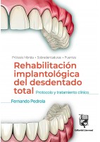REHABILITACION IMPLANTOLOGICA DEL DESDENTADO TOTAL. PROTOCOLO Y TRATAMIENTO CLINICO