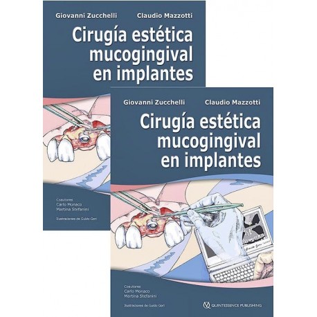 CIRUGIA ESTETICA MUCOGINGIVAL EN IMPLANTES (2 VOL.)