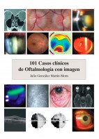 101 CASOS CLINICOS DE OFTALLMOLOGIA CON IMAGEN